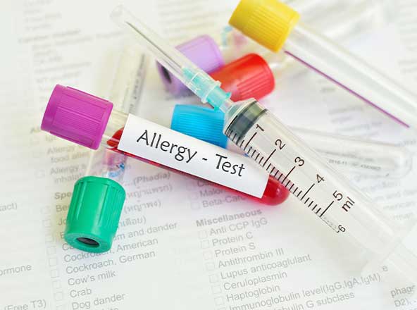 アレルギー検査